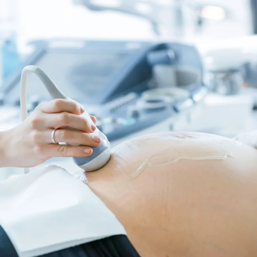 induslab-des-g011-gel-para-equipo-de-ultrasonido-diecogel-aplicador-250cc-bidon-5-lts-difem-2